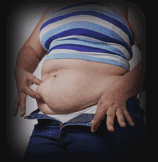 Obesity in America